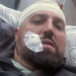 Pretučen Srbin iz Zubinog Potoka